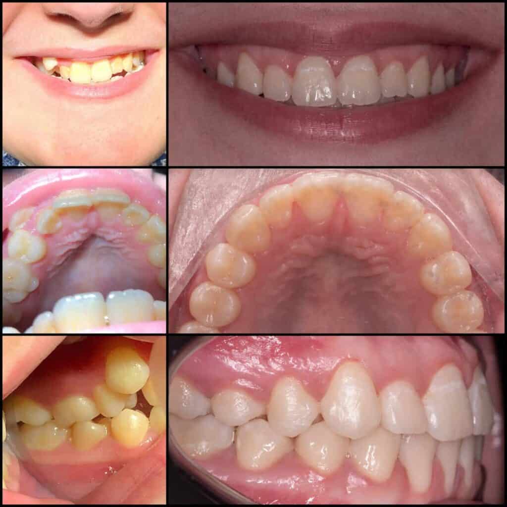 Before and After Image